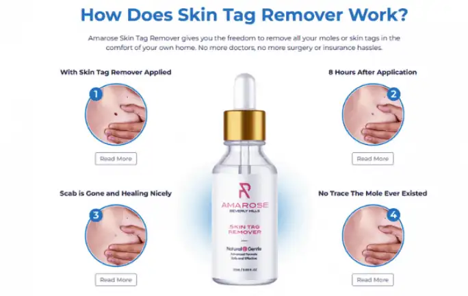 Amarose Skin Tag Remover Work Flow